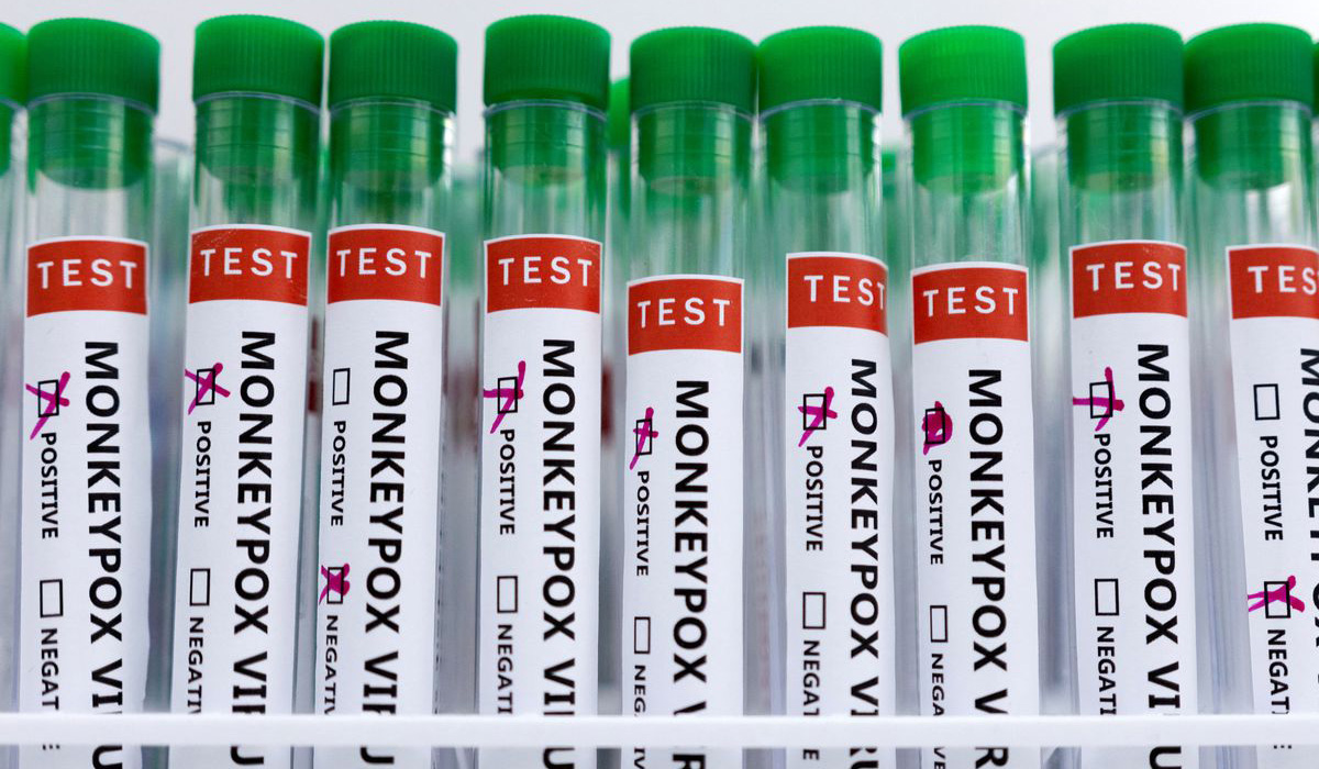 Monkeypox virus